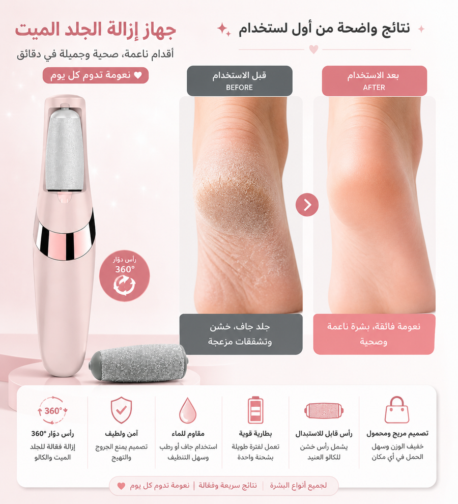 Electric Foot Callus Remover